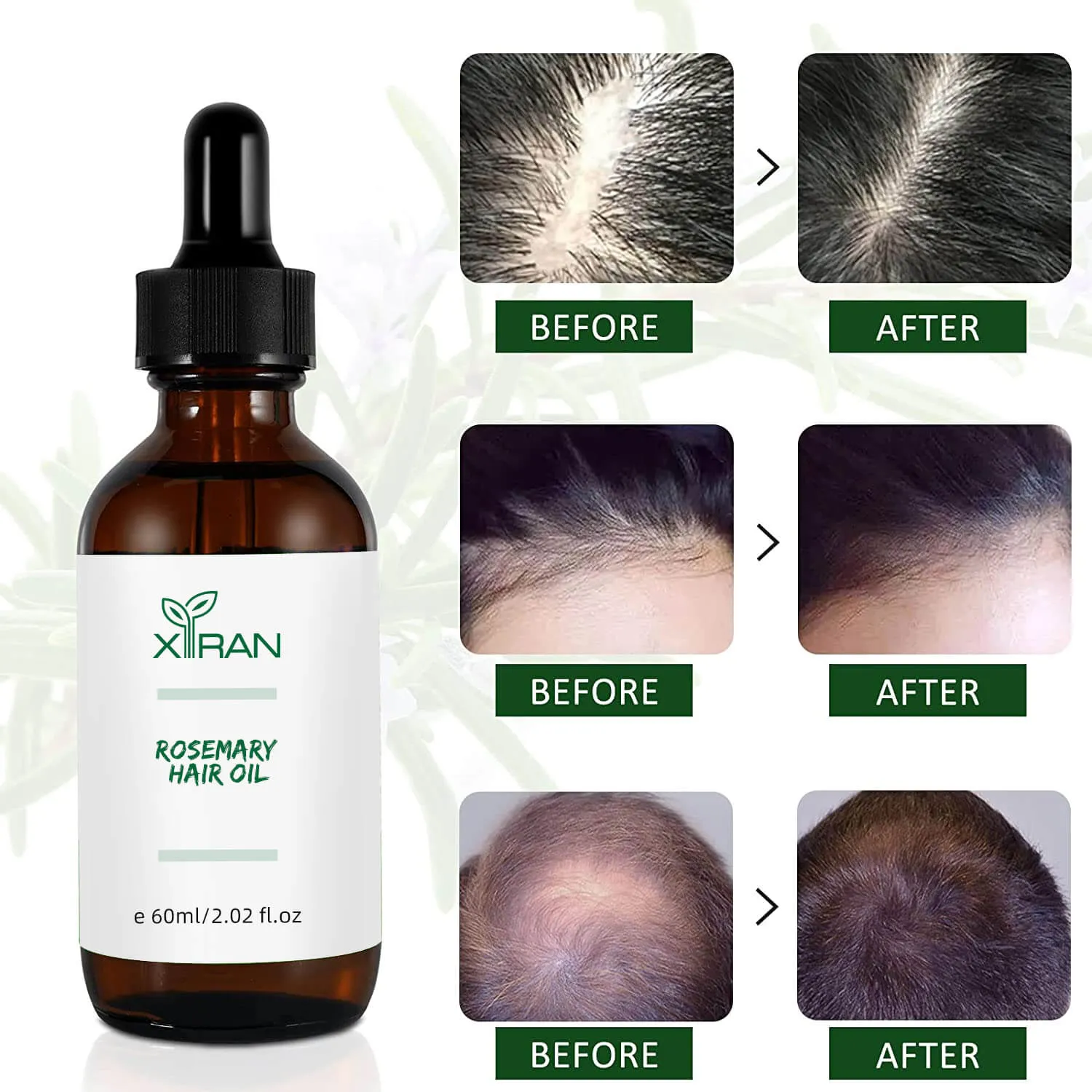 Customized Organic Pure Rosemary Oil For Men Women Anti Hair Loss ...